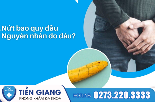 Nứt bao quy đầu xảy ra do nhiều nguyên nhân khác nhau.