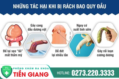 Rát bao quy đầu ở nam giới do nhiều bệnh lý viêm nhiễm gây ra