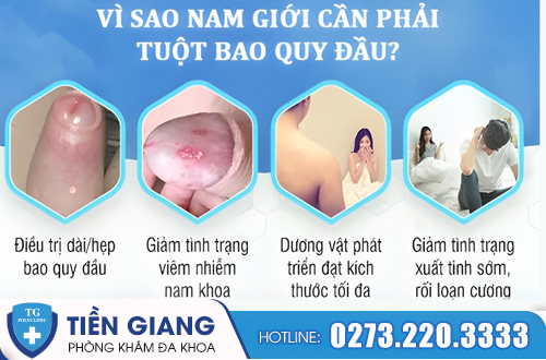 Lợi ích của việc tuột bao quy đầu.